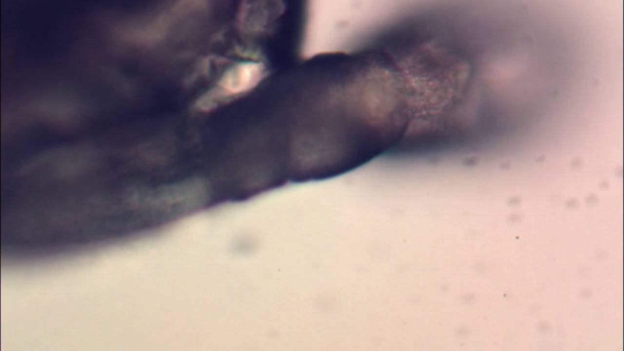 Живой паразит Демодекс под микроскопом, Human Demodex Follicles Mites смотреть онлайн