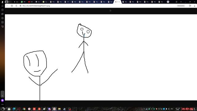 Сломал руку, чоооооооо, ипать, бегом смотреть, пон? смотреть онлайн