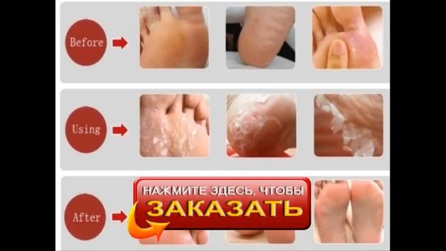Носочки для педикюра смотреть онлайн