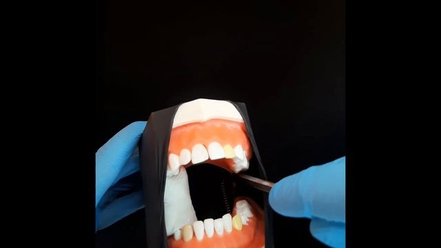 Мандибулярная анестезия. Как, зачем, почему? смотреть онлайн