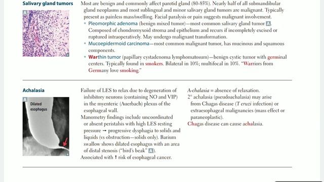Up To Date - GIT PATHOLOGY (part 1) [Sialolithiasis & achalasia ] смотреть онлайн