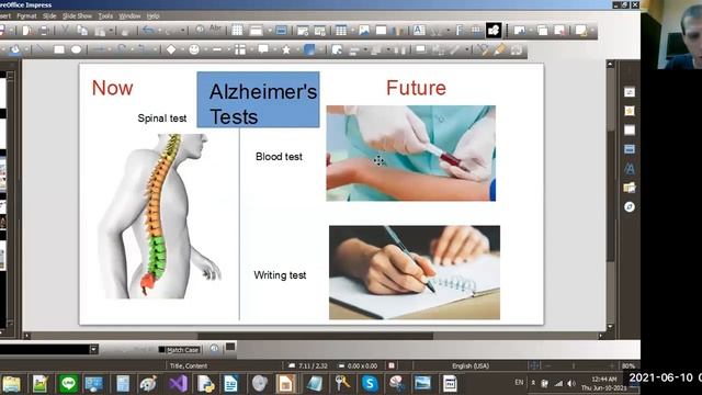 English Article Lesson Alzheimer's Disease Test: American in Taipei LINE ID: 55594449 смотреть онлайн