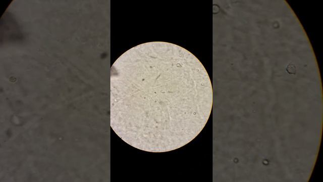 General urine examination = Mucous смотреть онлайн