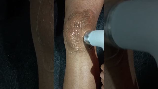ultrasonic therapy#painrelief #mpphysiotherapy#knee pain смотреть онлайн