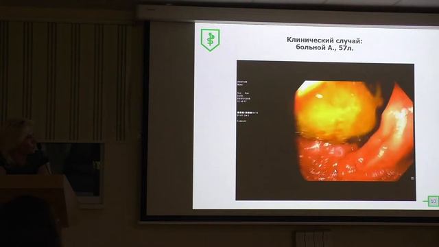 21 Коржева ИЮ Case Трудности эндоскопической интерпретации опухоли толстой кишки