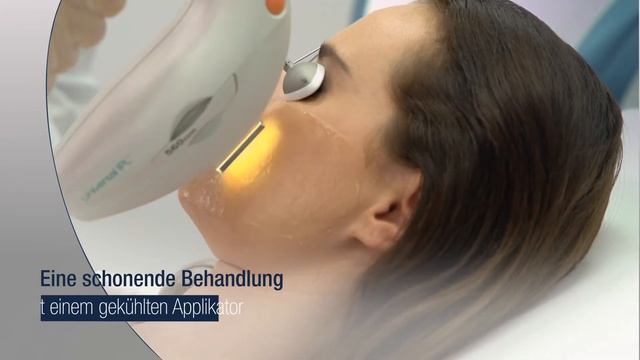 Lumenis® IPL Photorejuvenation Basel – Hautverjüngung Und Hautverbesserung Mit Laser
