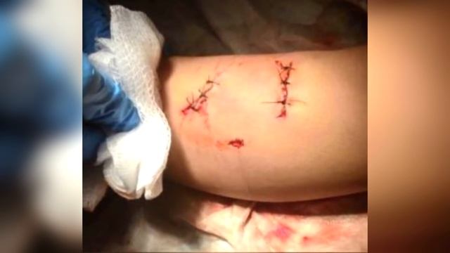 Кошки спасают людей!