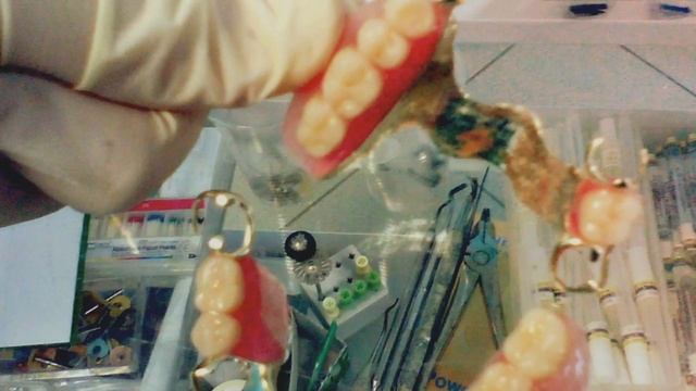 Лечение и протезирование зубов смотреть онлайн