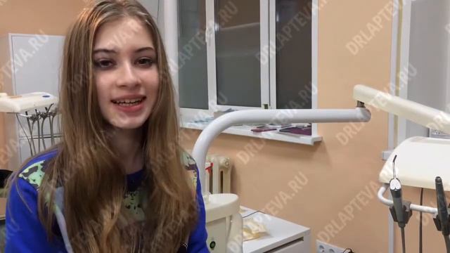 Ставить ли брекеты? Отзывы о лечении. смотреть онлайн