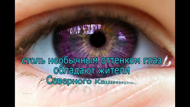 Самый редкий цвет глаз в мире смотреть онлайн