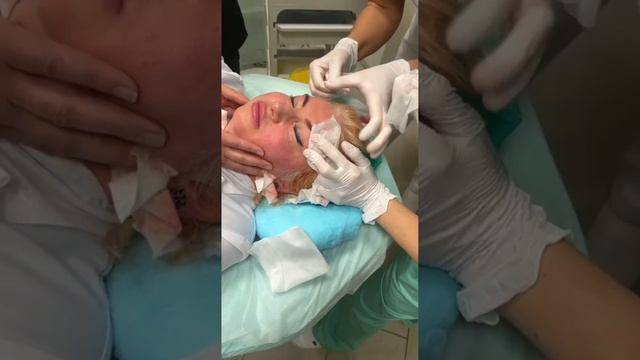 АирисКом студенты учатся: постановка нитей для поднятия верхнего века и бровей. смотреть онлайн