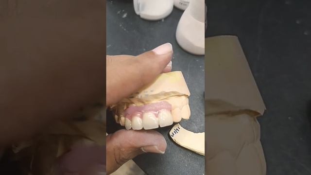 cement retained #Implant #pfm bridge #dentalcad #dental смотреть онлайн