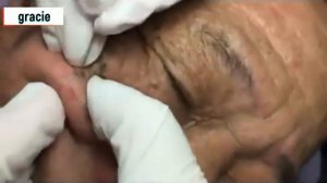 ЧИСТКА ЛИЦА МЕХАНИЧЕСКАЯ новое 2019