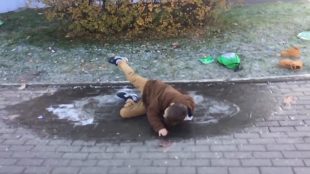 Упал и сломал ногу!!! смотреть онлайн