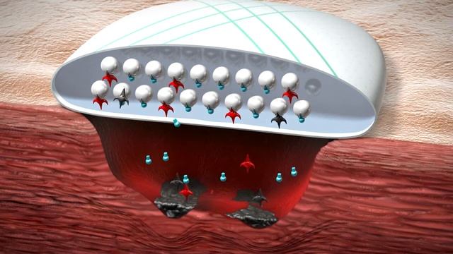 ГидроТерапия  механизм действия повязки HydroClean® Plus