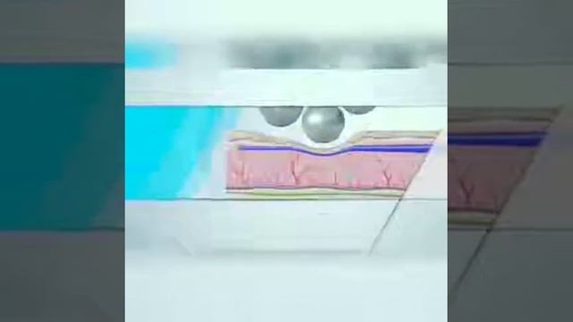 Эндосфера терапия - лучшее решение в борьбе за красоту тела смотреть онлайн