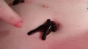 ASMR/пиявки на пупок/ leeches on the navel /