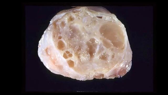 Gross Path of Lymph nodes 1 смотреть онлайн