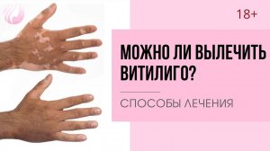 ЛЕЧЕНИЕ ВИТИЛИГО. КАК и ЧЕМ лечить витилиго. Способы лечения белых пятен на теле