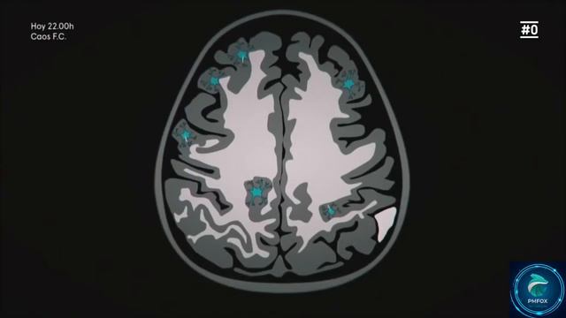🧠 El PODER del CEREBRO🦊 La INTELIGENCIA 💚 #ELPODERDELCEREBRO #PMFOXTECHNOLOGIES смотреть онлайн