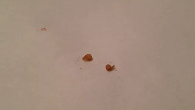 Улитковые пиявки смотреть онлайн