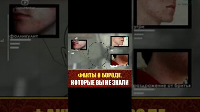 БОРОДА СУНА ПРОРОКА И ЕЩЁ ПОЛЕЗЕН МУХАММАД (С.А.В.) НА ЗДОРОВЬЕ смотреть онлайн