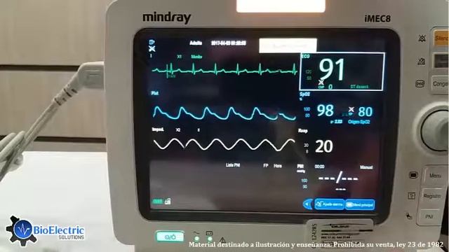 MANEJO Y CUIDADOS EL MONITOR DE SIGNOS VITALES MINDRAY IMEC8 смотреть онлайн