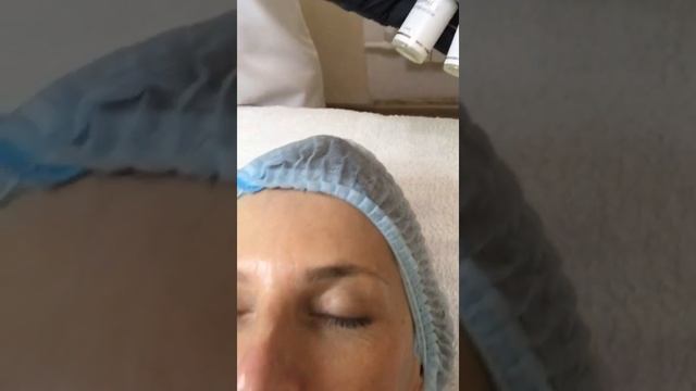 БАНКЕТНЫЙ уход за кожей лица смотреть онлайн