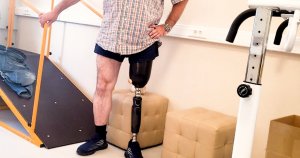 Сколько стоит протез ноги?