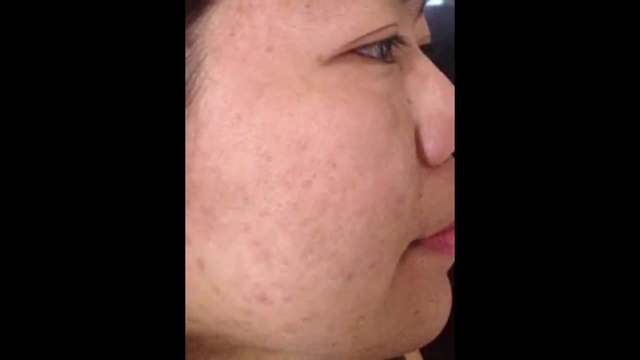 Здоровье и долголетие человека смотреть онлайн