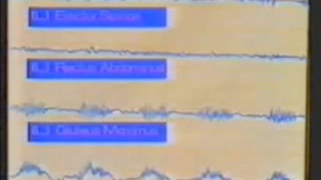 Реедукация мышечной системы по проф. Янде 3 из 5 смотреть онлайн