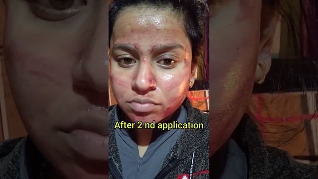 I TRIED THE ORDINARY PEELING SOLUTION #theordinarypeelingsolution #theordinary #shorts #ashortaday смотреть онлайн