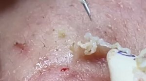 Enjoy Every Day With The Best Video Loan Nguyen Spa Official |  1026