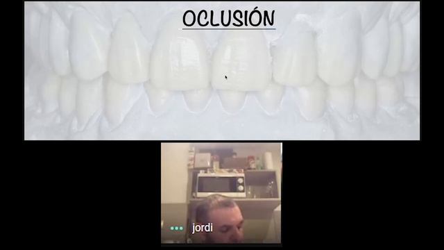 Oclusión Dentaria con Jordi, parte 2 смотреть онлайн