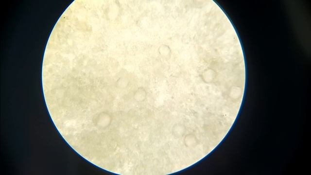 Что можно увидеть в зеленом авокадо под микроскопом?! смотреть онлайн