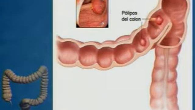 Dr RUBEN SANTOS - CENDOSA ENTREVISTA смотреть онлайн