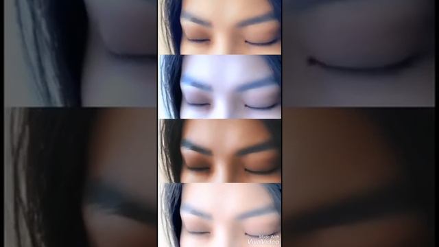 Блефаропластика доктор Бигельдиев Р. К. смотреть онлайн