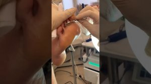 Фруктово-ферментативный педикюр FANI BEN AMI