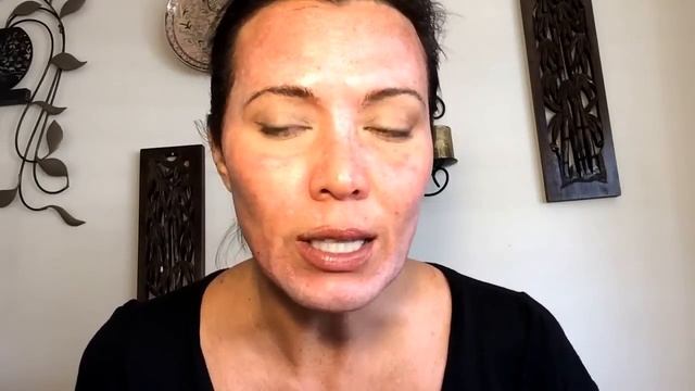 20% TCA FACIAL PEEL - STEP BY STEP TUTORIAL смотреть онлайн