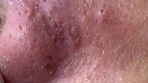 Satisfying Relaxing Best Video with Win Spa #118