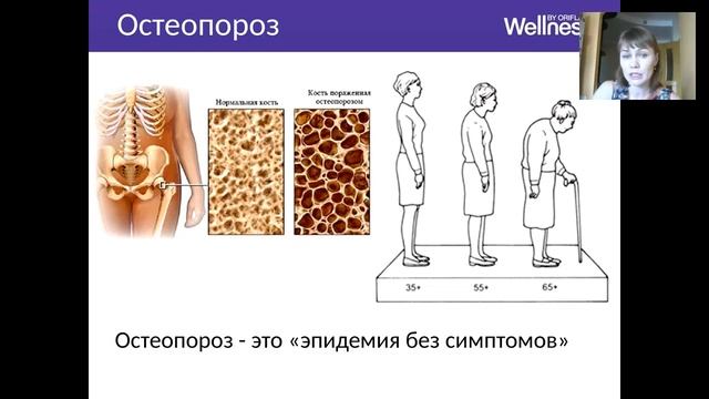 Как сохранить себя здоровым Велнес ПЭК – почему именно он Пасечникова Наталья 25 04 2016 смотреть онлайн