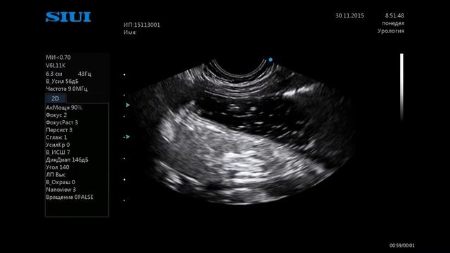 УЗИ желудка норма смотреть онлайн
