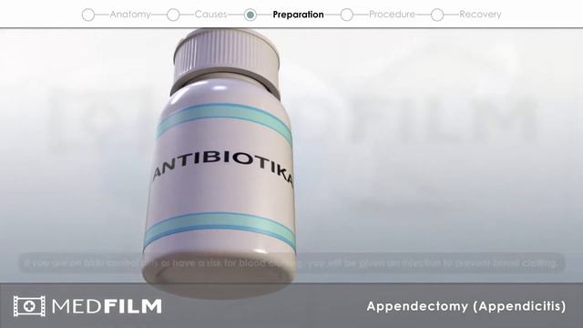 Appendectomy (Appendicitis) - Patient Film смотреть онлайн