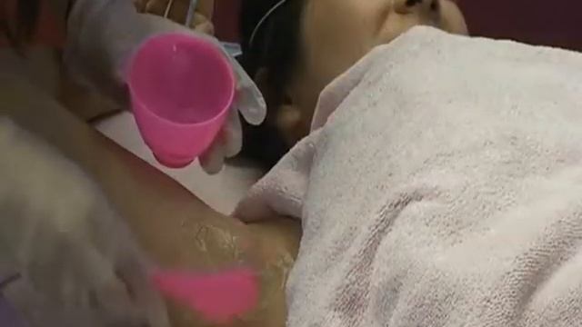 Аппарат AS 2020 SHR