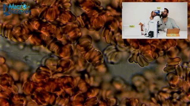 CANLI KAN HÜCRESİ İNCELEME ( SAĞLIKLI / BAKTERİLİ ) смотреть онлайн