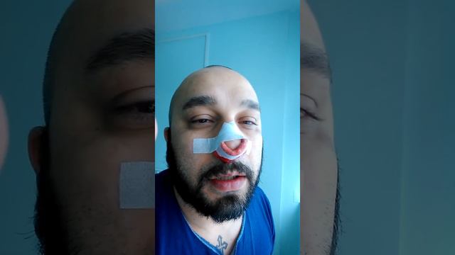 След упойката смотреть онлайн