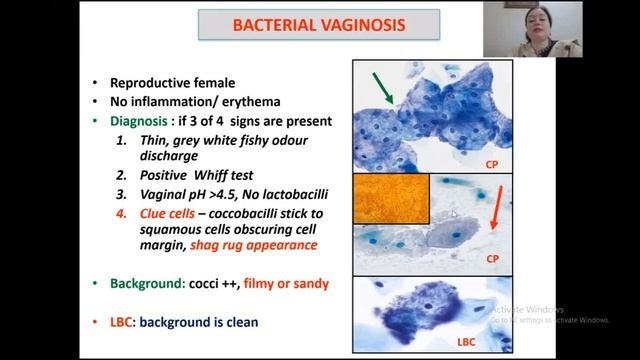 Bathesda system of Reporting Cervical cytology part 1 : NILM (Non neoplastic findings) with Cases смотреть онлайн