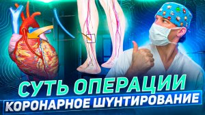Операция коронарное шунтирование, бляшки сосудов и ИНФАРКТ сердца