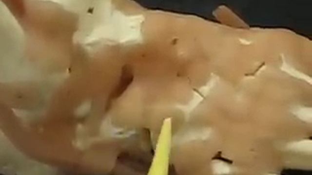 LATERAL VIEW OF LIGAMENTS & TENDONS OF THE FOOT смотреть онлайн