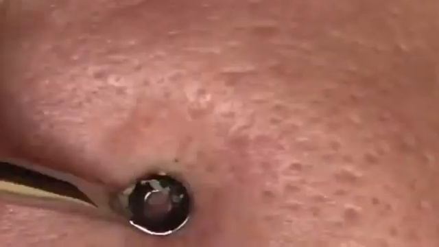 Чистка лица смотреть онлайн